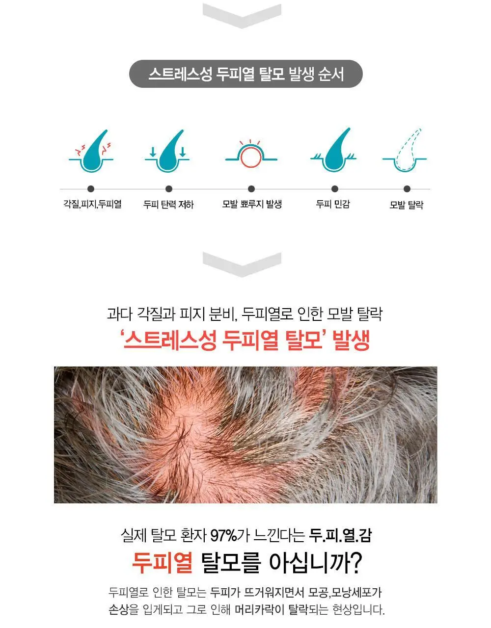 [텅장구조_탈모샴푸] 포레스트스토리 B7 안티 헤어 로스 쿨샴푸 200ml 상세페이지 4